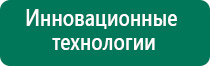 Чэнс скэнар базовая модель